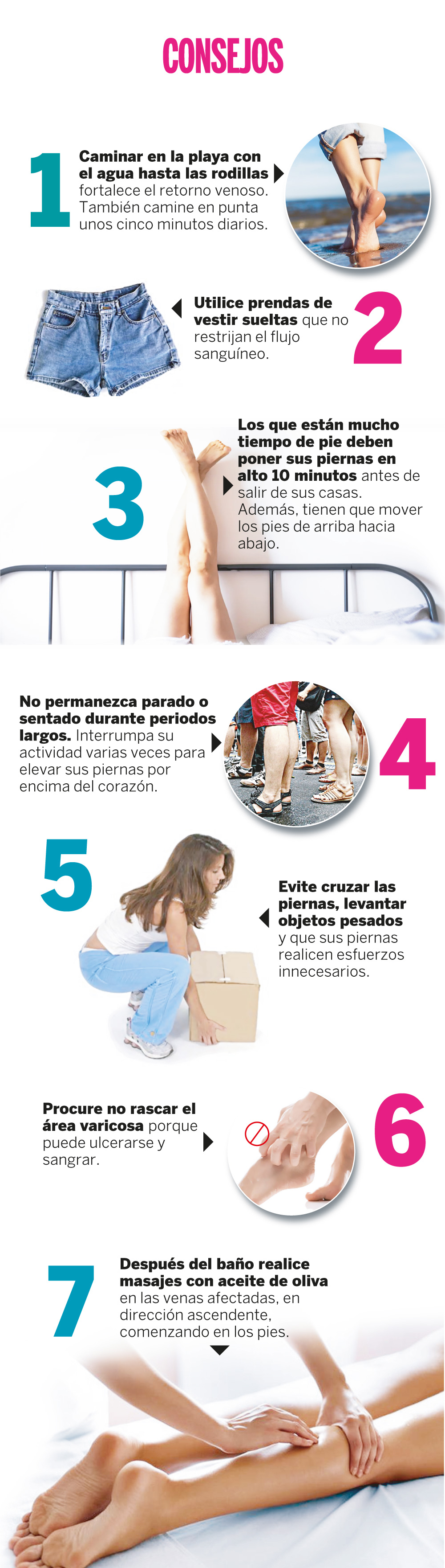 “Aquí te damos algunos de los mejores consejos para combatir las várices así como también algunos tratamientos que podrían ayudarte.