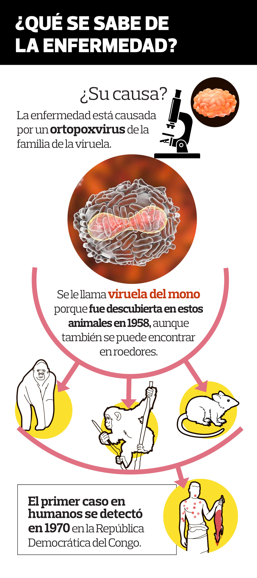 Qué es la viruela del mono, cómo se contagia y cuáles son sus síntomas